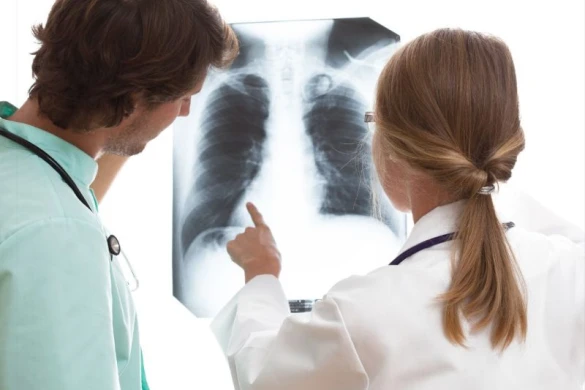 Test Oncología de pulmón pgx Test Oncología de pulmón pgx