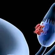 c0430a5d01623b20025ed53506d43545-catalogo-ovario-medicamentos-en-cancer-de-ovario c0430a5d01623b20025ed53506d43545-catalogo-ovario-medicamentos-en-cancer-de-ovario